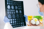 Alzheimer’s, Eggs and Alzheimer’s breakfast, eggs may help prevent alzheimer s study, May
