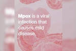 who on mpox, mpox cases, mpox emergency again, Tamil nadu government