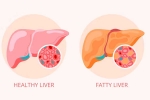 Grade 2 Fatty Liver health, Grade 2 Fatty Liver health, how to reverse grade 2 fatty liver, Your lifestyle