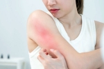 Skin Problems Treatment experts, Skin Problems Treatment naturally, skin problems that you can treat naturally, Remedies