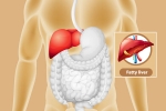 Fatty Liver tips, Fatty Liver, dangers of fatty liver, Who