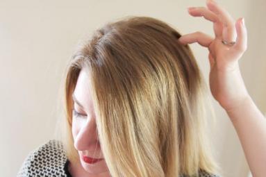 Remedies to get rid of Itchy scalp